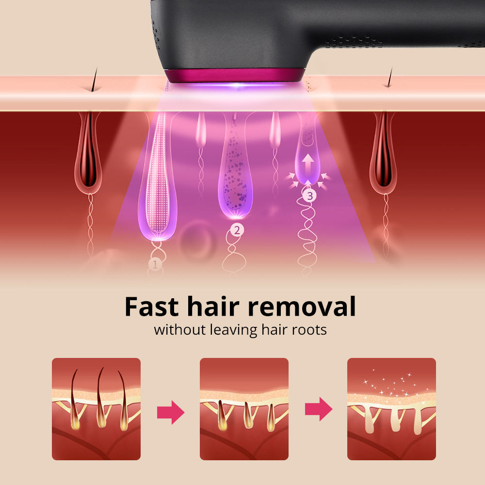 Painless Laser Hair Removal