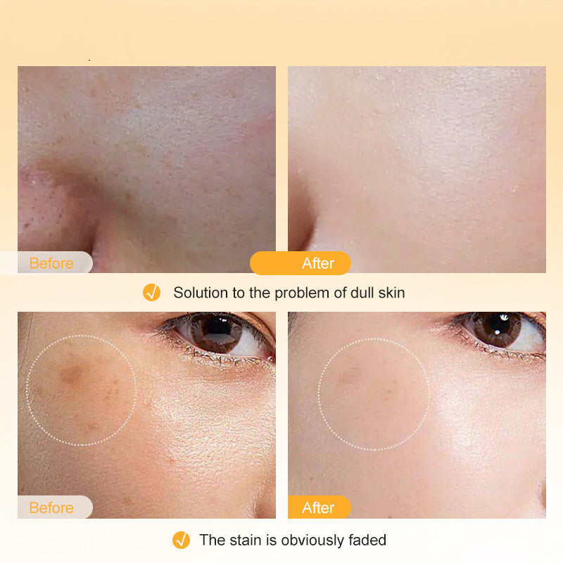 Vitamin C Facial Skin Care Serum